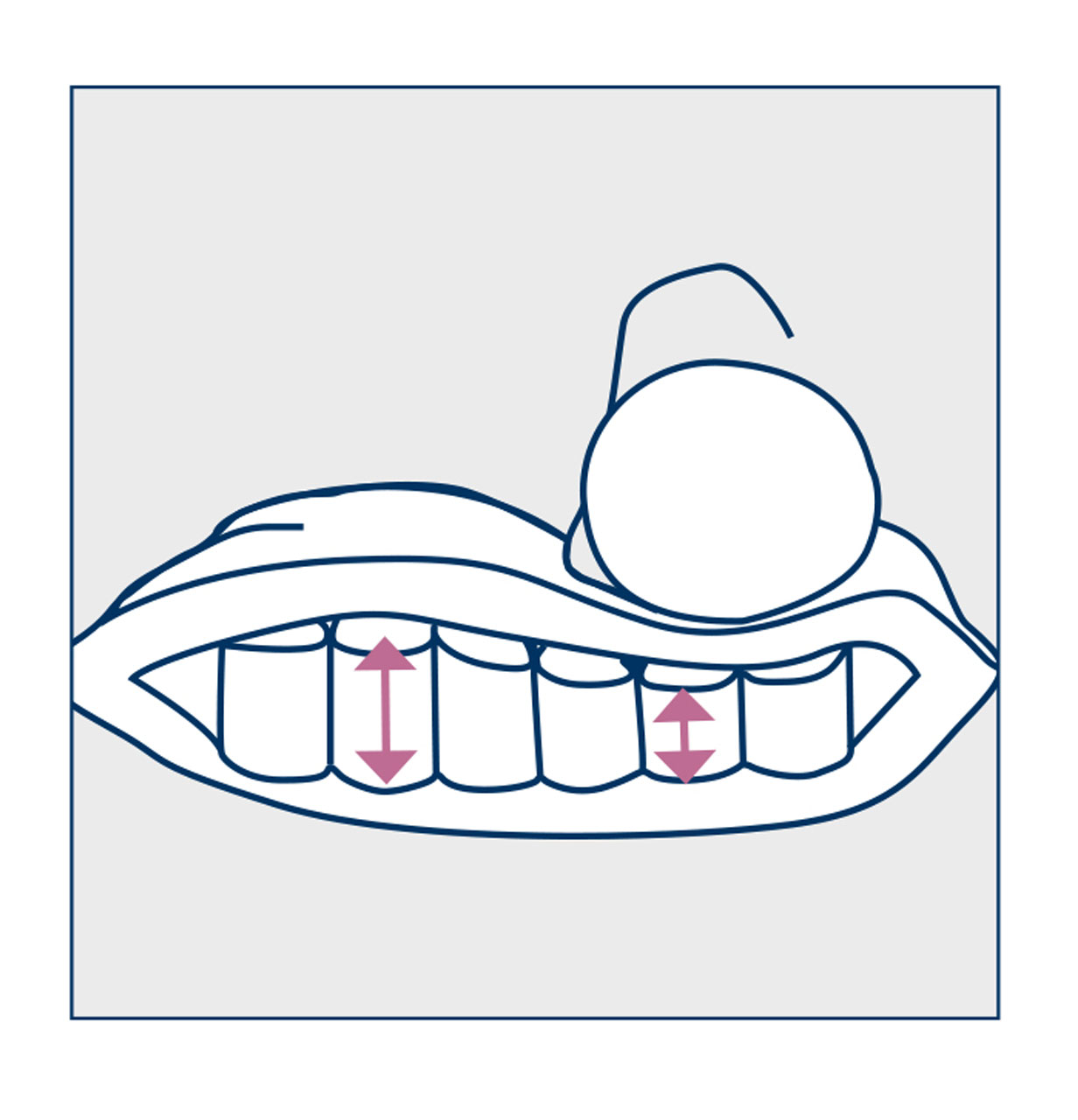 Schematic representation of the compression of the cylinders in the core of the Rondo neck support pillow from billerbeck